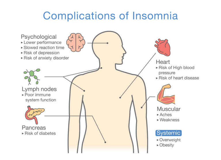 Boxed Warning Alert For Certain Insomnia Medications Drug And Device 