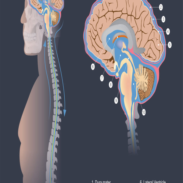 Integra LifeSciences and FDA Medical Device Recall of CSF Systems ...