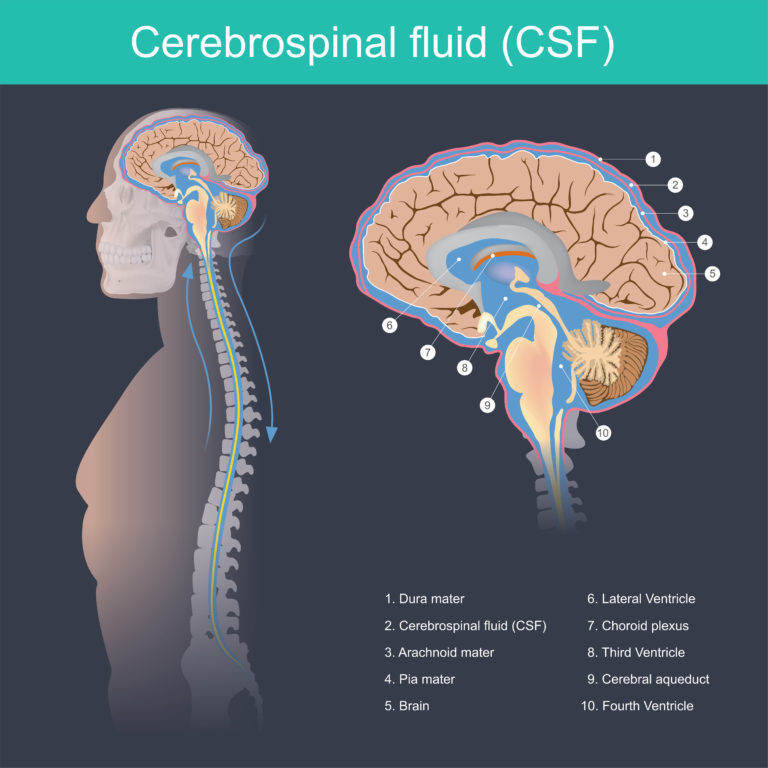 Integra LifeSciences and FDA Medical Device Recall of CSF Systems ...